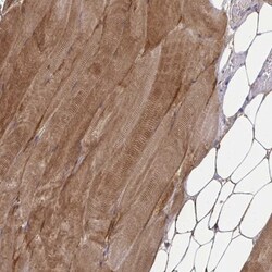 ZNF498 Antibody, Novus Biologicals 25 &mu;L | Buy Online | Novus Biologicals | Fisher Scientific